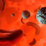 Hope for Those with Sickle Cell Disease