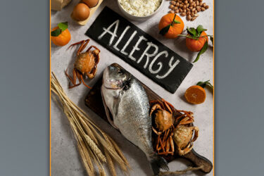 Navigating Food Allergies & Dietary Needs at Camp
